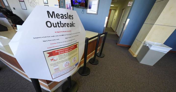 Eight more people infected with measles in SC outbreak