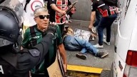 La Policía de Bullrich le fracturó un brazo a un jubilado: "Está internado y lo tienen que operar"