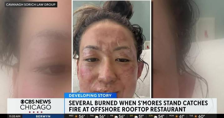 Multiple people sue after being burned when s'mores stand catches fire at restaurant