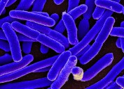 Contaminated Cheese From Washington Creamery Sickens People in Oregon and Washington