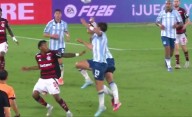 El duro golpe que recibió Santiago Sosa por un codazo de Marcos Rojo: así le quedó el ojo