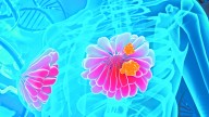 Testimonios: La batalla de mujeres mexicanas contra el cáncer de mama