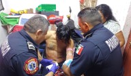 Se corta el brazo con vidrios rotos