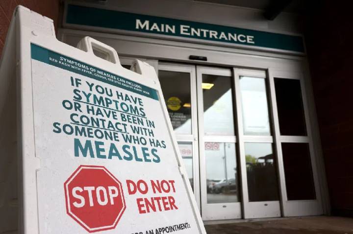 Canada’s status as a country without endemic measles can now be revoked