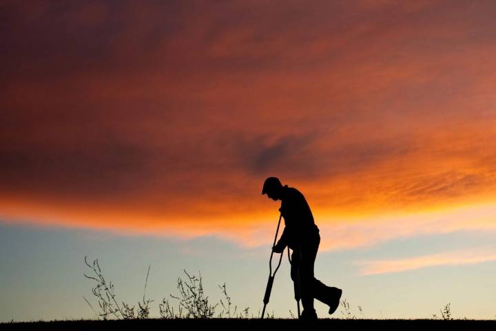 Por qué los huesos frágiles no es solo un problema de las mujeres