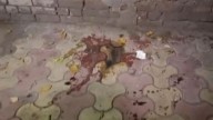 Delhi college student injured in acid attack by stalker near Laxmi Bai College