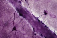 Brain Model with Key Tissue Types Enables Personalized Disease and Drug Research