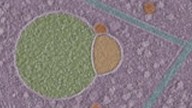 Scientists discover never-before-seen 'snowman wearing scarf' in human cells