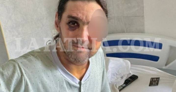 Operativo del CTI y la Sijín permite la captura de sospechoso por la brutal agresión a Tarzán en Caldas