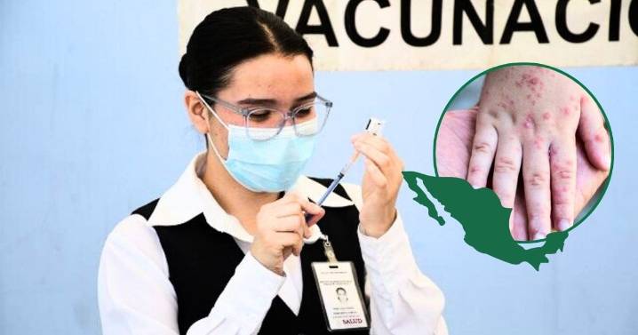 Secretaría de Salud refuerza la vacunación contra el sarampión en México con la aplicación de más de 8 millones de dosis para contener el brote