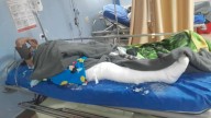 EPS niega cirugía vital a joven accidentada que lucha por volver a caminar