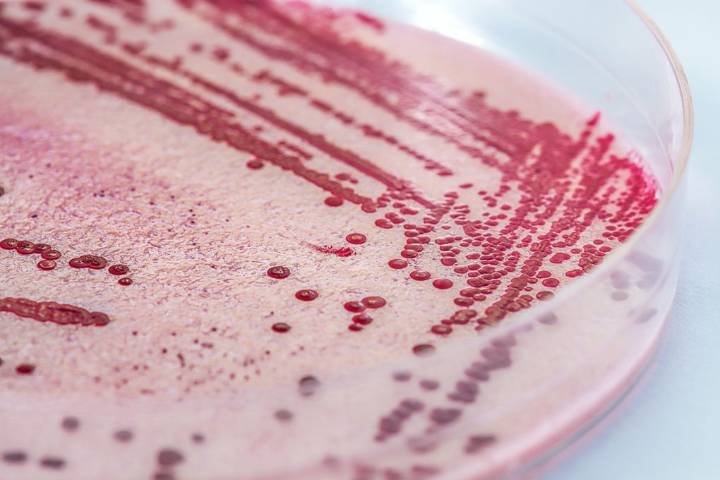 Publix and Walmart sell the newest recalled food in the deadly listeria outbreak