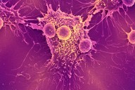 COVID-19 mRNA vaccines could unlock the next revolution in cancer treatment – new research