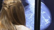 Cataluña pospone la ampliación de los cribados de mama y colon por falta de profesionales