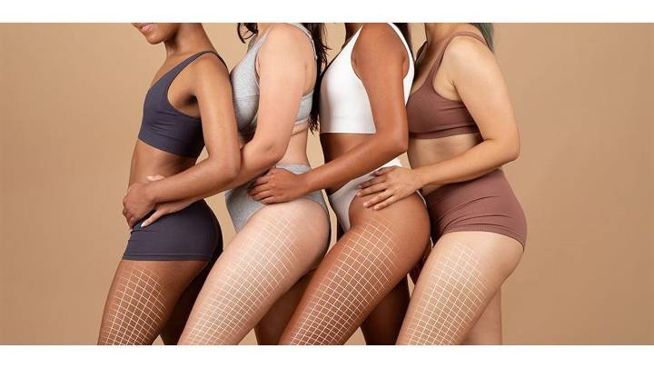 From cellulite to sculpted: The non-invasive solution everyone is talking about