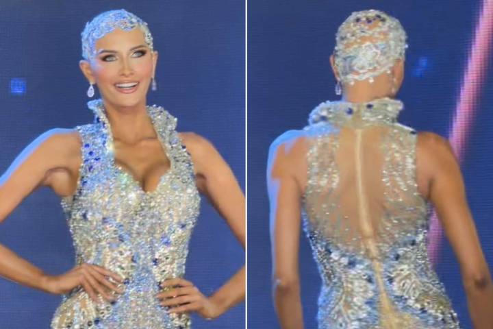 Miss USA Contestant with Alopecia Ditches Wig During Pageant
