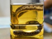 Snakebite surge as Bangladesh hit by record rains