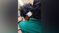 Stray dog that attacked three-year-old girl in Ernakulam tests positive for rabies