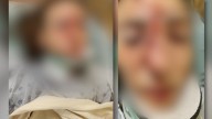 Community supports Hampton family after teen gets hit by car while riding bike to school