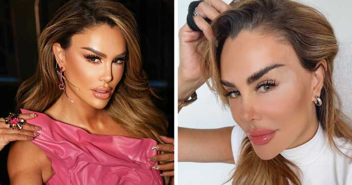 “Risking Blindness”: Actress Reveals She Had Controversial Surgery To Change Her Eye Color