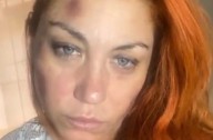 Lourdes Fernández denunció a su pareja en 2022 y dejó una frase que conmovió: “El amor no duele”