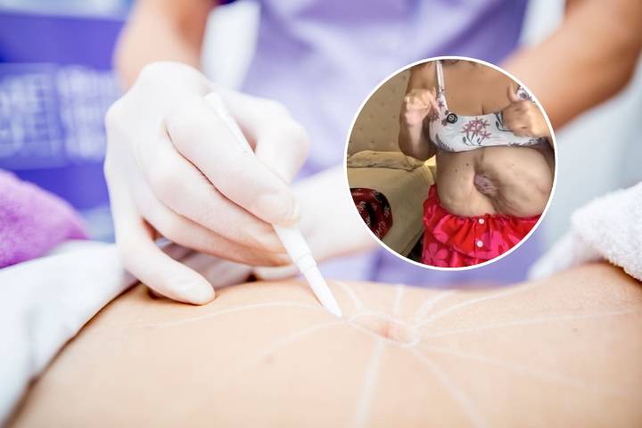 “Movilizaron mis intestinos con las manos”: la desgarradora historia de la influencer que sobrevivió sin estómago tras una cirugía estética fallida