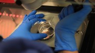 El uso de inteligencia artificial para la detección precoz del cáncer se ensaya en la provincia de Alicante