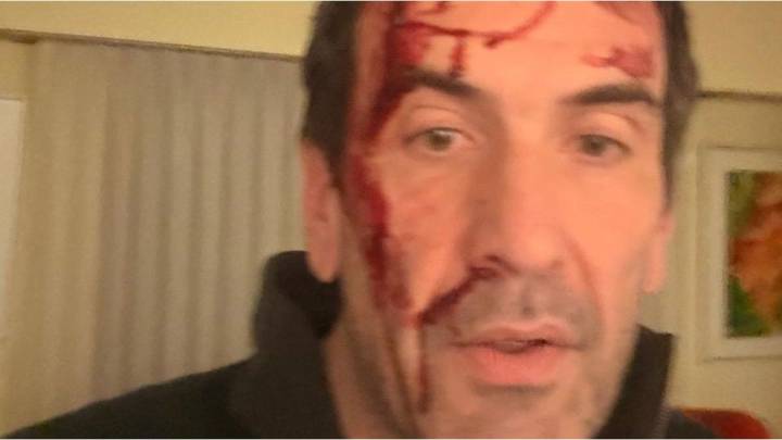 Elecciones 2025: asaltaron y golpearon a Pablo Cervi, candidato de la Libertad Avanza en Neuquén