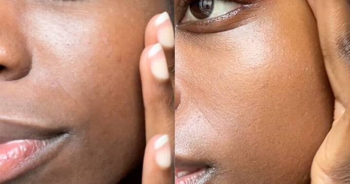 The £2 beauty trick that's winning awards for its '97% smoother skin' results