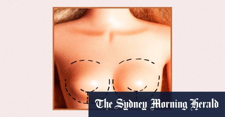 Breast implant explant trend: Alyssa Milano and other celebrities ditching large implants like those of Kylie Jenner for smaller, natural look