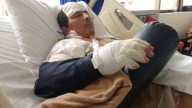 Campesino espera cirugía urgente tras accidente con motosierra: Nueva EPS no autoriza el procedimiento