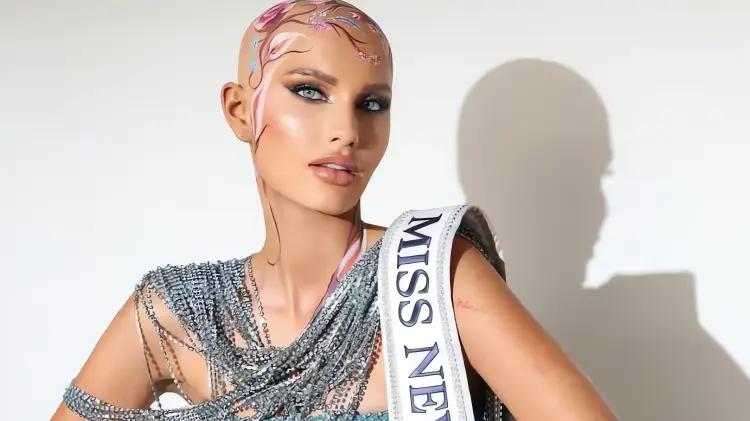 La mujer sin pelo que reescribió las reglas de la belleza en Miss Estados Unidos