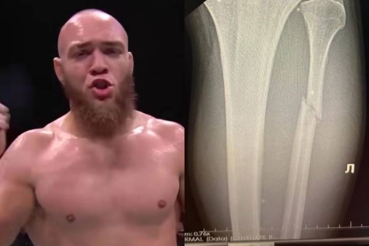 Valter Walker Forced to Reveal Leg Injury After UFC 321 Win