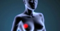 Los conjugados anticuerpo-fármaco se imponen a la quimio en cáncer de mama triple negativo metastásico, según estudio