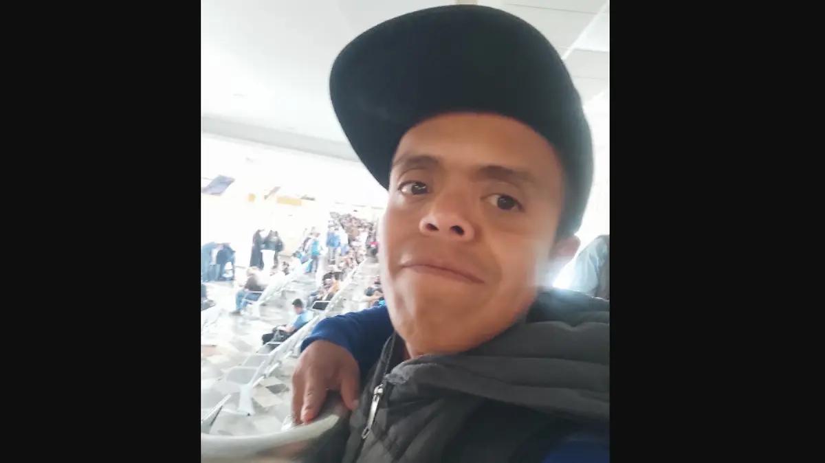 ¿Qué es la acondroplasia, condición genética de Medio Metro Original? Te contamos
