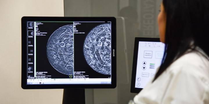 Así es como el IMSS recomienda hacer la autoexploración para detectar a tiempo el cáncer de mama
