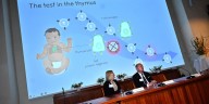 Hallazgo clave sobre el sistema inmune: el Nobel de Medicina premió los estudios sobre las células T reguladoras