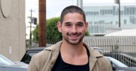 Fans Shocked After 'DWTS' Dancer Alan Bersten's Face Appears to be Covered in Scars