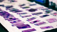 European cancer researchers release guidelines on AI use in oncology