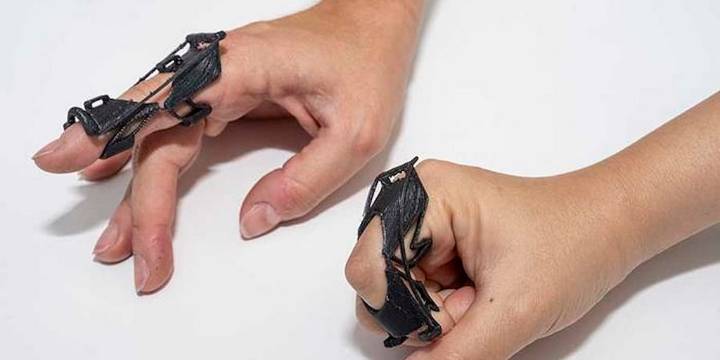 Aparato ortopédico personalizable facilita rehabilitación y cuidado de artritis
