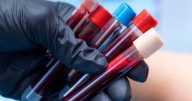 El peor tipo de sangre: un estudio científico reveló el grupo que tiene más posibilidades de sufrir infartos