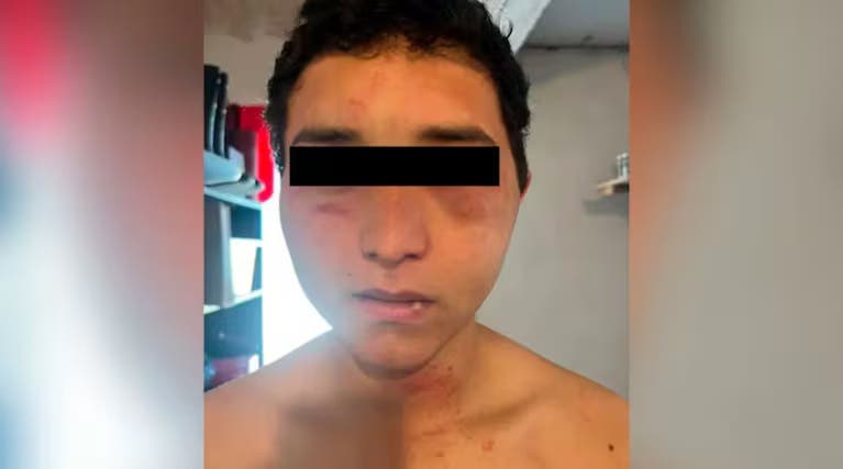 Un trabajador rural denunció que fue torturado por sus jefes: “Me sacaron la oreja con los dientes”