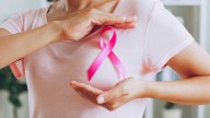 Rising rates of early-onset breast cancer: Busting the myths