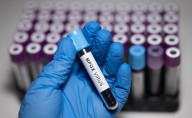 Restoring Monkeypox Name Creates Chaos