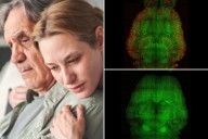 Nanotech used to reverse Alzheimer's disease in mice: study