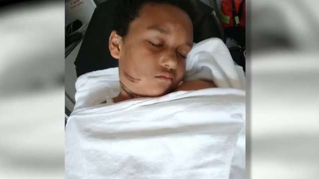 Louisiana boy seriously injured by tablet charger