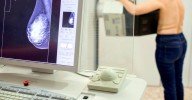 Andalucía admite errores en el diagnóstico de cáncer de mama de 2.000 mujeres
