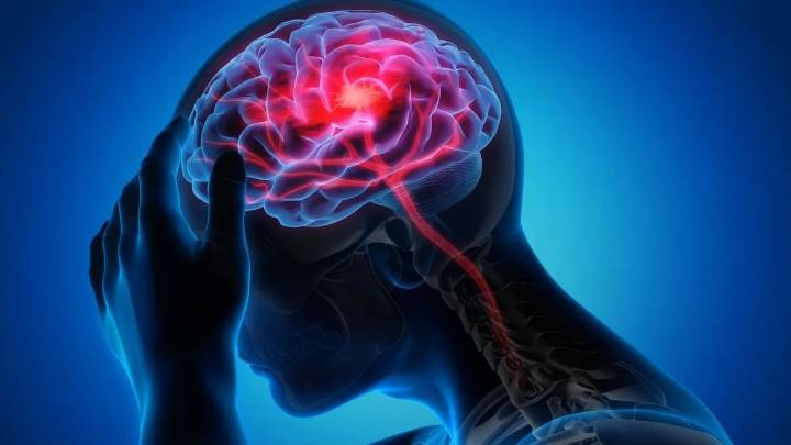 World Stroke Day: Reminding urgency in recognising, preventing life