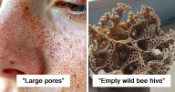 80 Harmless-Looking Pics That Are Actually Nightmare Fuel For People With Trypophobia (New Pics)