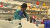 Concerns rise over NIH budget cuts impact on breast cancer research, innovation
